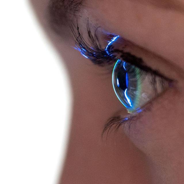 Das Auge einer Patientin beim Augenarzt