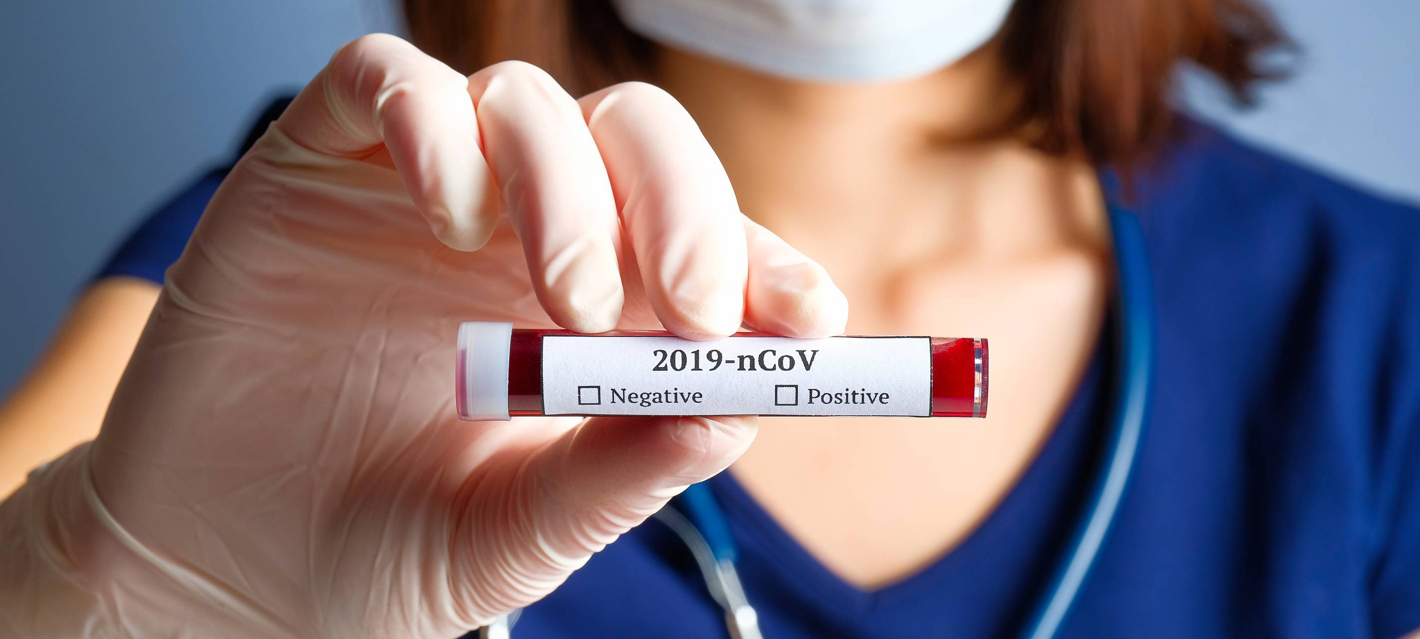 Corona: Krefeld hat Duisburg im Blick